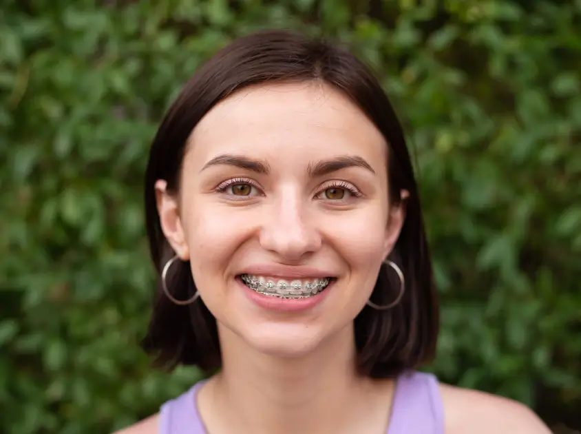 Dental Braces
