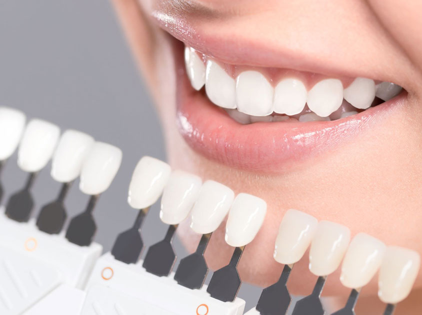 Dental Implants
